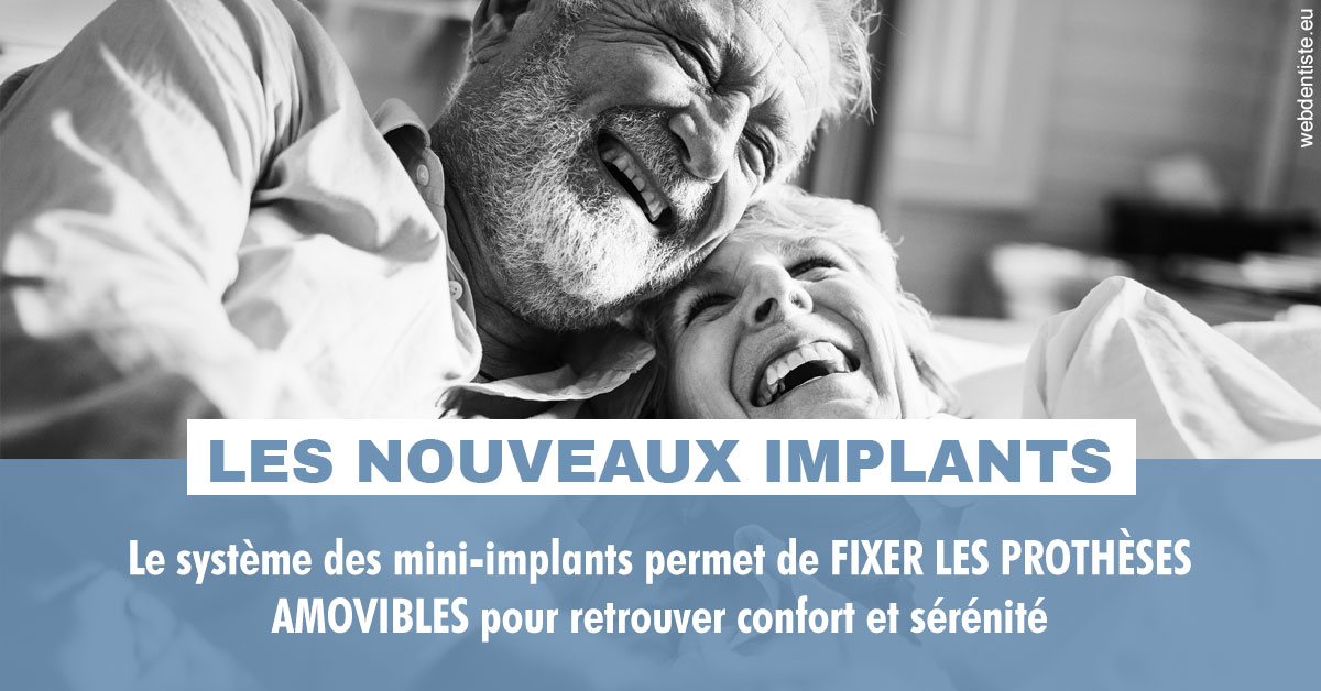 https://dr-renoux-alain.chirurgiens-dentistes.fr/Les nouveaux implants 2