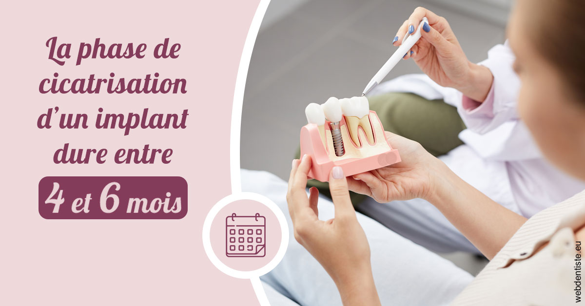 https://dr-renoux-alain.chirurgiens-dentistes.fr/Cicatrisation implant 2