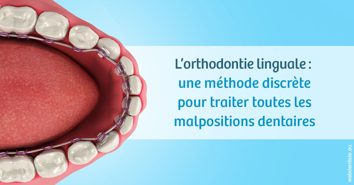 https://dr-renoux-alain.chirurgiens-dentistes.fr/L'orthodontie linguale 1
