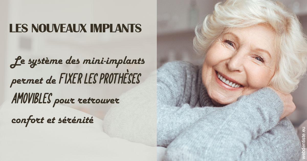 https://dr-renoux-alain.chirurgiens-dentistes.fr/Les nouveaux implants 1