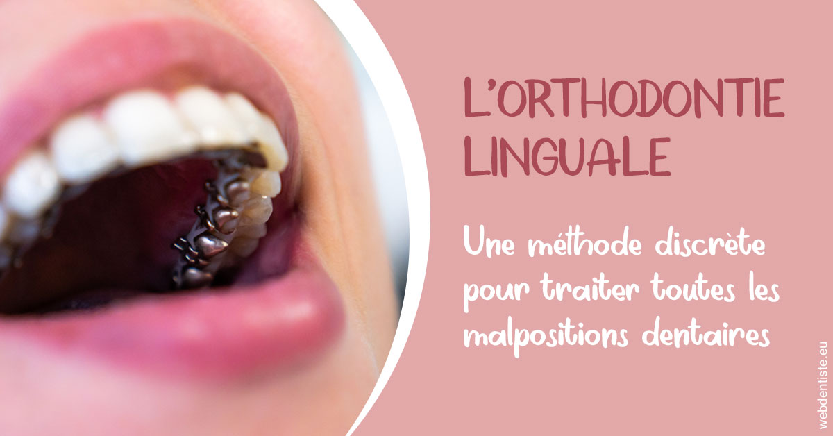 https://dr-renoux-alain.chirurgiens-dentistes.fr/L'orthodontie linguale 2
