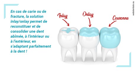https://dr-renoux-alain.chirurgiens-dentistes.fr/L'INLAY ou l'ONLAY