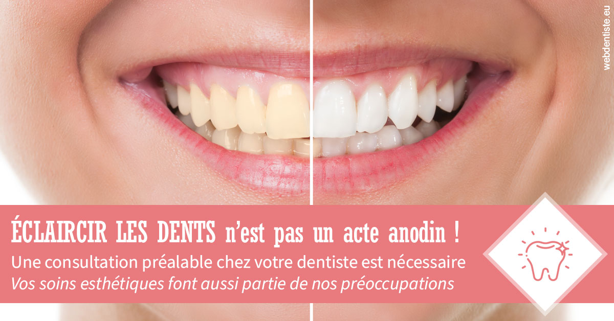 https://dr-renoux-alain.chirurgiens-dentistes.fr/Eclaircir les dents 1
