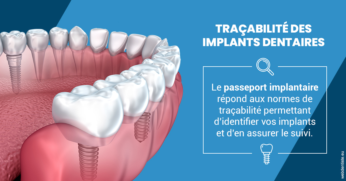 https://dr-renoux-alain.chirurgiens-dentistes.fr/T2 2023 - Traçabilité des implants 1