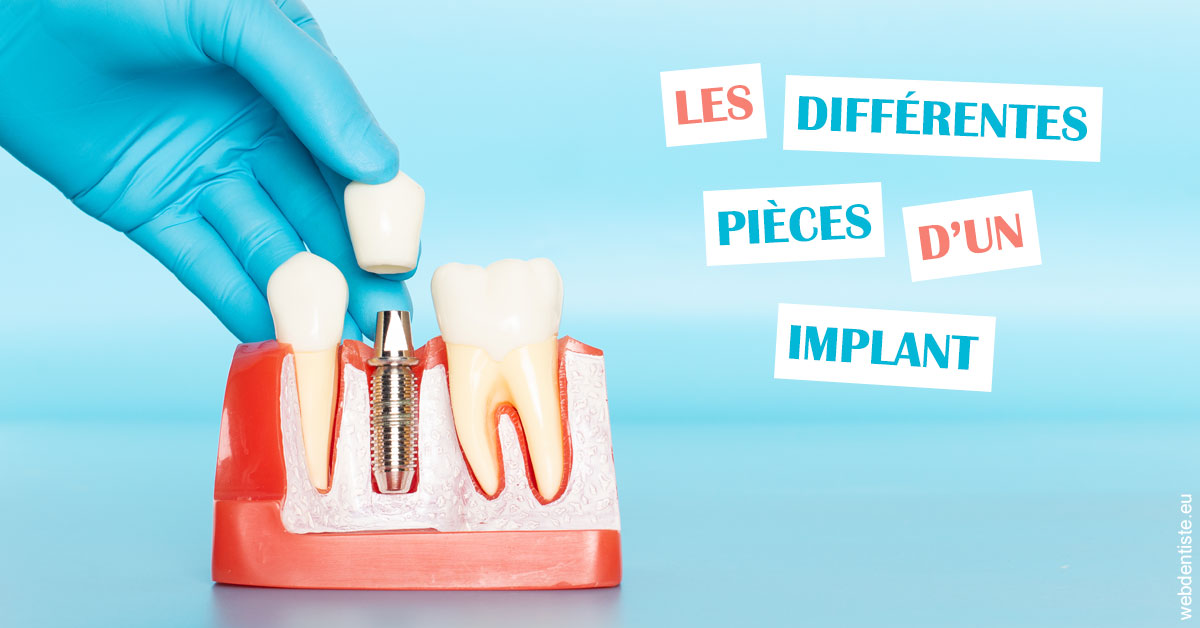 https://dr-renoux-alain.chirurgiens-dentistes.fr/Les différentes pièces d’un implant 2