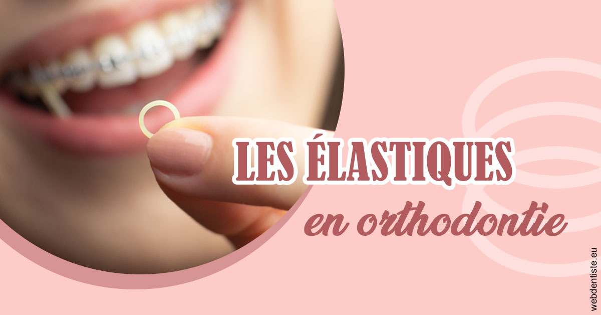 https://dr-renoux-alain.chirurgiens-dentistes.fr/Elastiques orthodontie 1