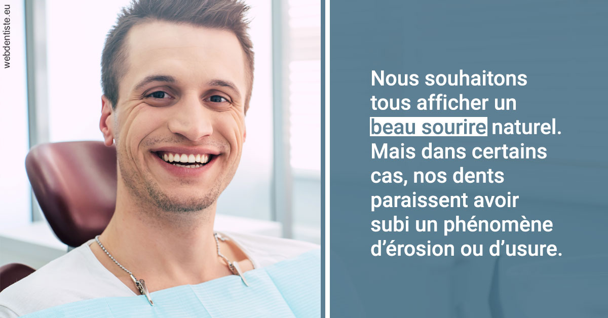 https://dr-renoux-alain.chirurgiens-dentistes.fr/Érosion et usure dentaire