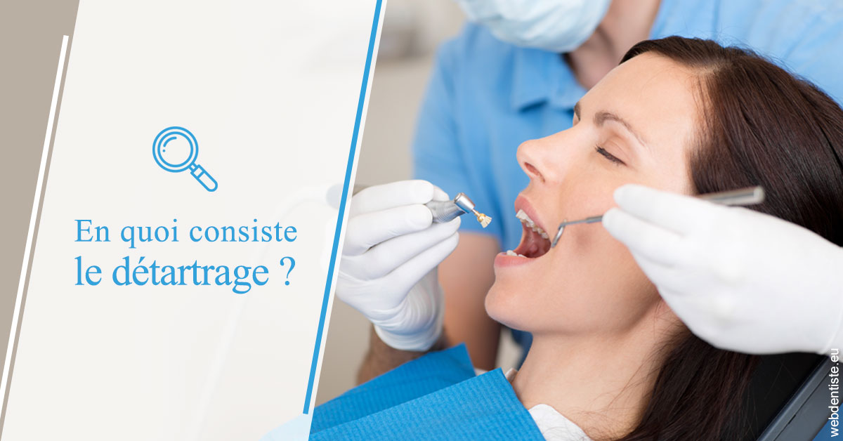 https://dr-renoux-alain.chirurgiens-dentistes.fr/En quoi consiste le détartrage