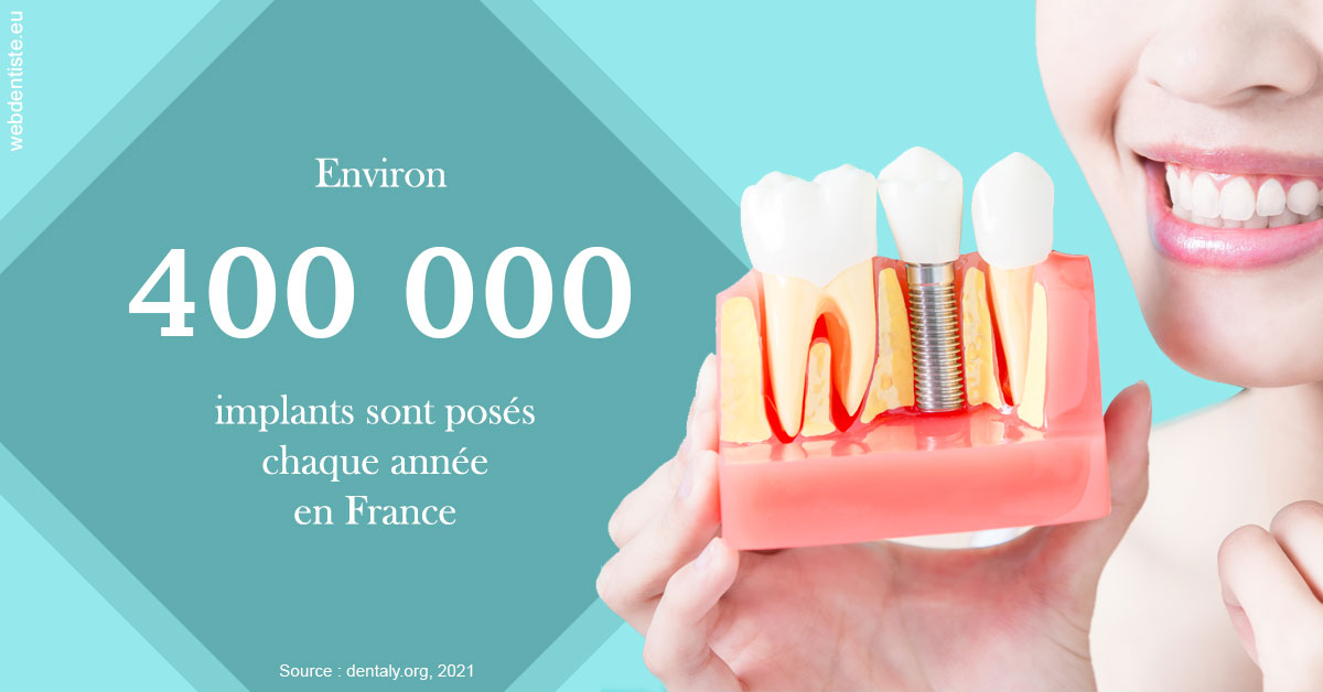 https://dr-renoux-alain.chirurgiens-dentistes.fr/Pose d'implants en France 2