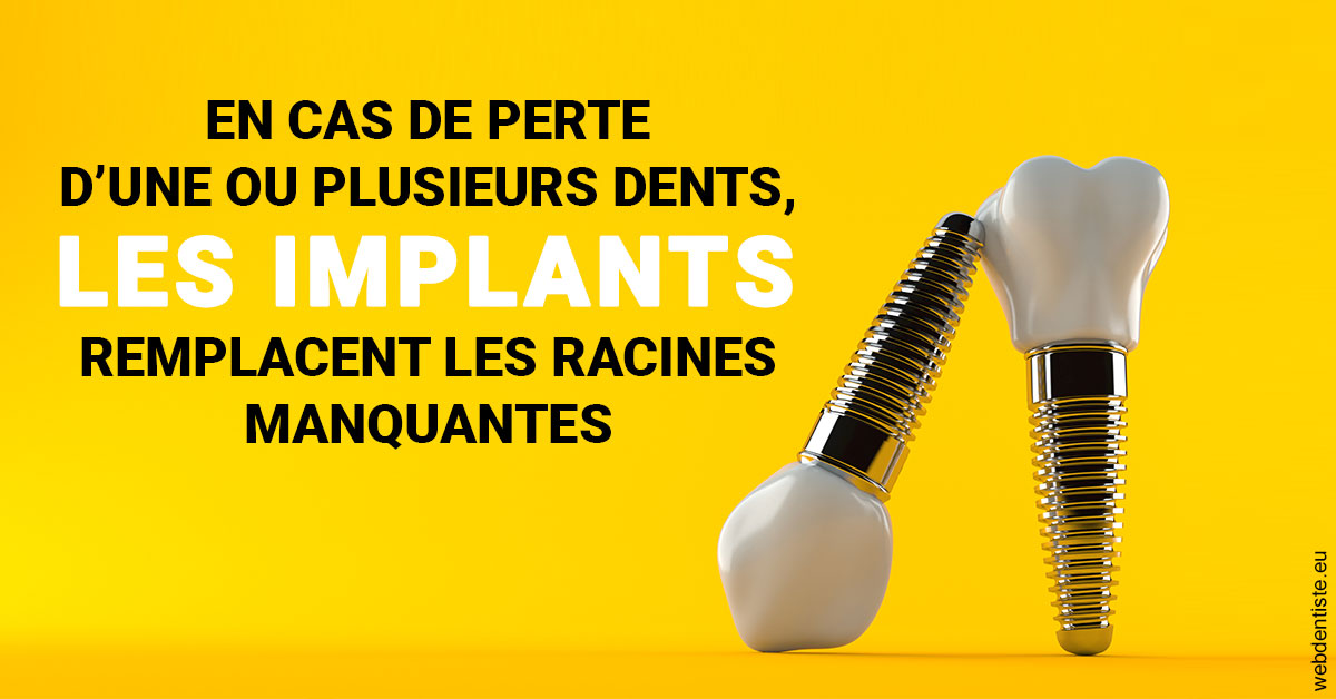 https://dr-renoux-alain.chirurgiens-dentistes.fr/Les implants 2