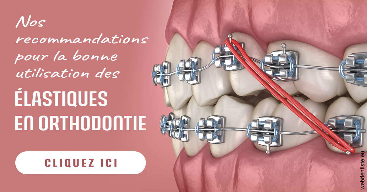 https://dr-renoux-alain.chirurgiens-dentistes.fr/Elastiques orthodontie 2